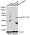 AP-2 complex subunit mu antibody, LS-C750630, Lifespan Biosciences, Western Blot image 