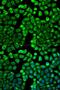 Histamine N-Methyltransferase antibody, LS-C332135, Lifespan Biosciences, Immunofluorescence image 