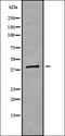 Cytochrome P450 Family 4 Subfamily Z Member 1 antibody, orb336313, Biorbyt, Western Blot image 