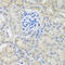 BCL2 Interacting Protein 3 antibody, OAAN03512, Aviva Systems Biology, Immunohistochemistry paraffin image 