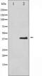 Eukaryotic translation initiation factor 2 subunit 1 antibody, TA325444, Origene, Western Blot image 