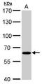 Cystathionine beta-synthase antibody, TA308071, Origene, Western Blot image 