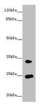 Melanoregulin antibody, orb25053, Biorbyt, Western Blot image 