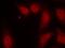 Cell Division Cycle 25C antibody, A01343-1, Boster Biological Technology, Immunofluorescence image 