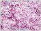 STEAP2 Metalloreductase antibody, AP23950PU-N, Origene, Immunohistochemistry frozen image 
