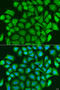 TNF Receptor Associated Factor 3 antibody, A15106, ABclonal Technology, Western Blot image 