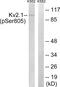 Potassium Voltage-Gated Channel Subfamily B Member 1 antibody, LS-C199180, Lifespan Biosciences, Western Blot image 