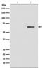 Protein Kinase AMP-Activated Catalytic Subunit Alpha 2 antibody, P01420-1, Boster Biological Technology, Western Blot image 