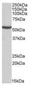 Aldehyde Dehydrogenase 6 Family Member A1 antibody, AP22423PU-N, Origene, Western Blot image 