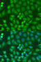 Zinc Finger FYVE-Type Containing 16 antibody, 23-168, ProSci, Immunofluorescence image 