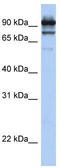 Signal Transducer And Activator Of Transcription 6 antibody, TA329203, Origene, Western Blot image 