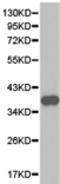 Thrombopoietin antibody, TA323653, Origene, Western Blot image 