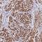 Neuroepithelial Cell Transforming 1 antibody, HPA020068, Atlas Antibodies, Immunohistochemistry frozen image 