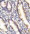 RAB35, Member RAS Oncogene Family antibody, A03845-1, Boster Biological Technology, Immunohistochemistry paraffin image 