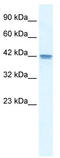 Olfactory Receptor Family 13 Subfamily C Member 9 antibody, TA329446, Origene, Western Blot image 