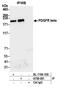 Platelet Derived Growth Factor Receptor Beta antibody, A700-081, Bethyl Labs, Immunoprecipitation image 