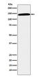 Glycoprotein Ib Platelet Subunit Alpha antibody, M02073-2, Boster Biological Technology, Western Blot image 
