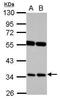 Ras Association Domain Family Member 7 antibody, GTX101740, GeneTex, Western Blot image 
