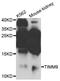 Mitochondrial import inner membrane translocase subunit Tim9 antibody, STJ26765, St John