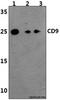 CD9 Molecule antibody, GTX66709, GeneTex, Western Blot image 