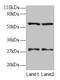 SARS antibody, CSB-PA04145A0Rb, Cusabio, Western Blot image 