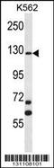 MCF.2 Cell Line Derived Transforming Sequence antibody, 56-509, ProSci, Western Blot image 