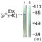 BMX Non-Receptor Tyrosine Kinase antibody, LS-C198937, Lifespan Biosciences, Western Blot image 