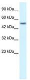 Ankyrin Repeat Domain 11 antibody, TA333877, Origene, Western Blot image 