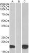 Pleckstrin Homology Like Domain Family A Member 3 antibody, TA311404, Origene, Western Blot image 
