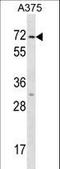 Keratin 75 antibody, LS-C165637, Lifespan Biosciences, Western Blot image 