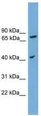 Signal Peptide Peptidase Like 3 antibody, TA340322, Origene, Western Blot image 