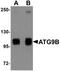 Autophagy Related 9B antibody, orb94525, Biorbyt, Western Blot image 