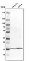 Glia Maturation Factor Beta antibody, NBP1-89755, Novus Biologicals, Western Blot image 