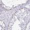 Oocyte Secreted Protein 2 antibody, NBP2-33601, Novus Biologicals, Immunohistochemistry paraffin image 