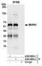 Makorin Ring Finger Protein 1 antibody, A300-990A, Bethyl Labs, Immunoprecipitation image 