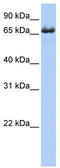 Zinc Finger DHHC-Type Containing 17 antibody, TA341967, Origene, Western Blot image 