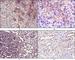 5'-Nucleotidase Ecto antibody, abx016042, Abbexa, Western Blot image 