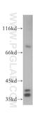 SGT1 Homolog, MIS12 Kinetochore Complex Assembly Cochaperone antibody, 11675-1-AP, Proteintech Group, Western Blot image 