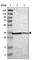 Cathepsin E antibody, HPA012940, Atlas Antibodies, Western Blot image 