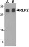 RILP-like protein 2 antibody, LS-B8819, Lifespan Biosciences, Western Blot image 