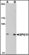 SPG11 Vesicle Trafficking Associated, Spatacsin antibody, orb89230, Biorbyt, Western Blot image 