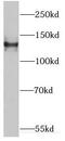 EMAP Like 4 antibody, FNab02758, FineTest, Western Blot image 