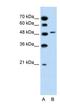 Sodium/bile acid cotransporter 5 antibody, NBP1-59707, Novus Biologicals, Western Blot image 