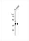 Phosphatidylinositol-5-Phosphate 4-Kinase Type 2 Gamma antibody, LS-C101120, Lifespan Biosciences, Western Blot image 