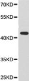 Pyruvate Dehydrogenase E1 Alpha 1 Subunit antibody, TA321101, Origene, Western Blot image 