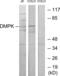 Myotonin-protein kinase antibody, abx013585, Abbexa, Western Blot image 