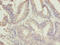 Chromosome 10 Open Reading Frame 82 antibody, CSB-PA837861LA01HU, Cusabio, Immunohistochemistry paraffin image 