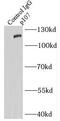 RB Transcriptional Corepressor Like 1 antibody, FNab06057, FineTest, Immunoprecipitation image 