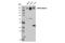 ATP Binding Cassette Subfamily C Member 4 antibody, 12857S, Cell Signaling Technology, Western Blot image 