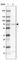 Cytochrome P450 Family 4 Subfamily V Member 2 antibody, HPA029122, Atlas Antibodies, Western Blot image 